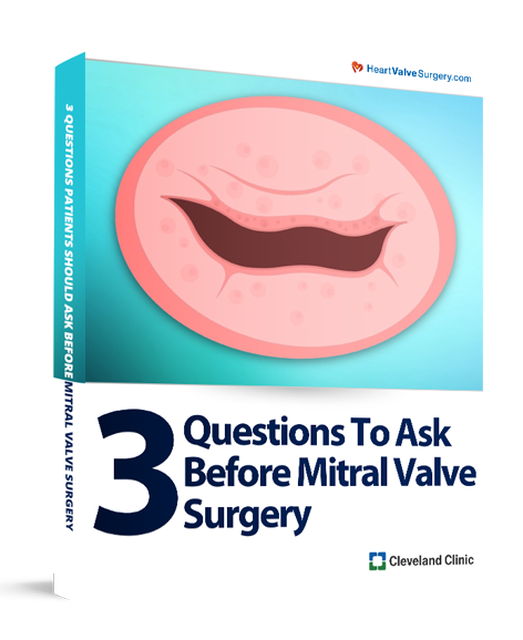3 Questions to Ask BeforeMitral Valve Surgery