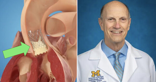 TAVR Patient Information