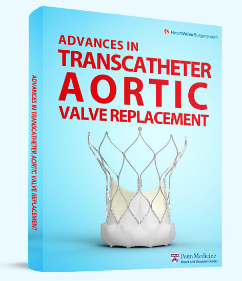 Advances in Transcatheter Aortic Valve Replacement (TAVR)
