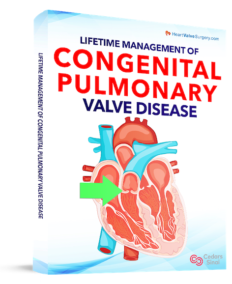Lifetime Management of Congenital Pulmonary Valve Disease