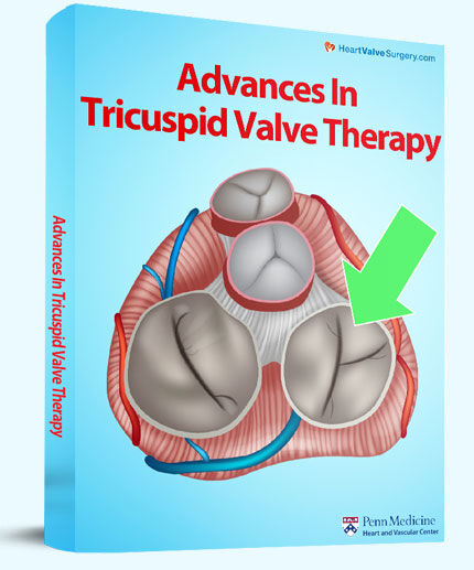 Advances inTricuspid Valve Therapy
