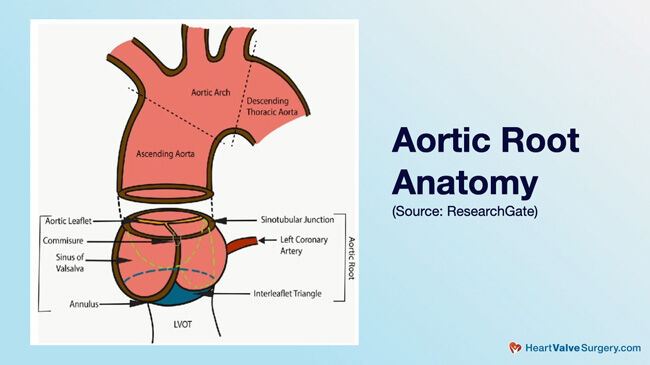Aortic Root Anatomy