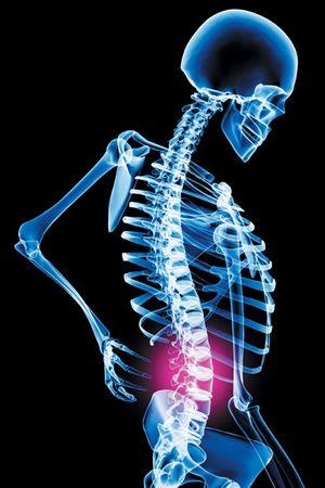 Back Pain &amp; Mitral Valve Prolapse