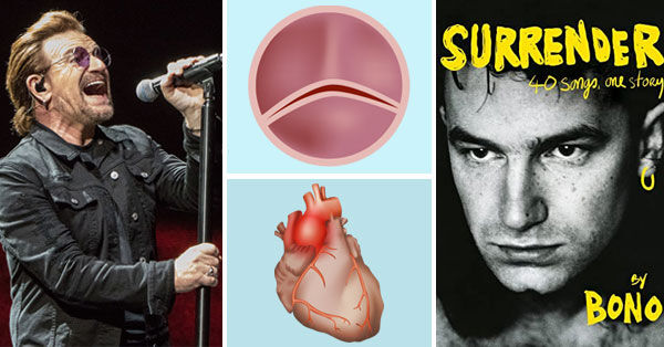 Bono Heart Valve &amp; Aneurysm Surgery