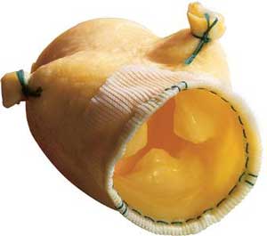 Pig Valve Transplant