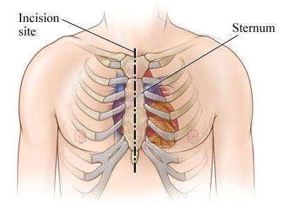 Top 10 Heart Valve Surgery Blogs 2010