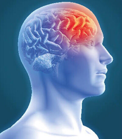 Stroke Complication After Heart Surgery
