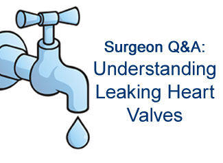 Surgeon Q&amp;A with Dr. Accola