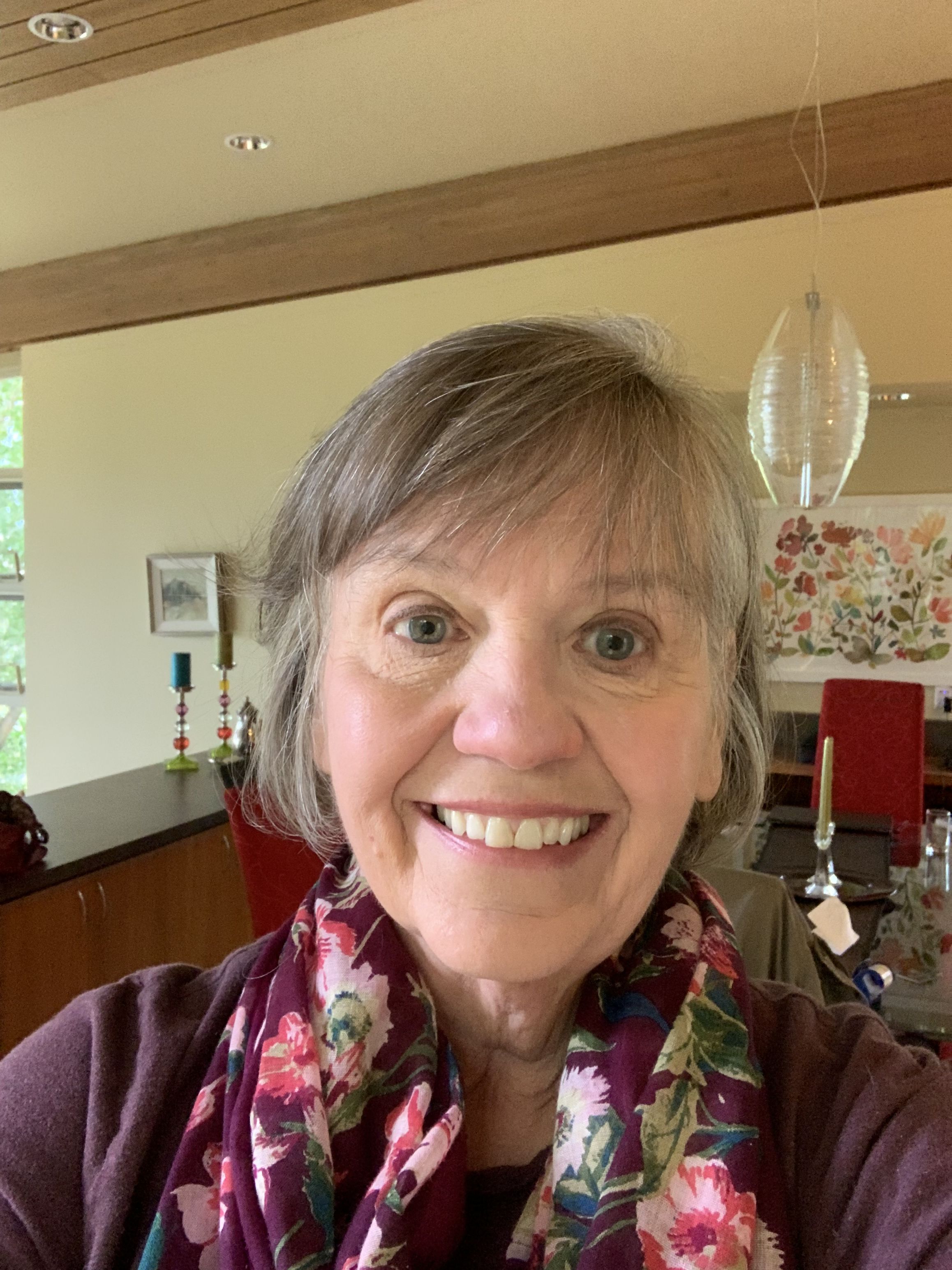 One year ago today I was undergoing open heart surgery for an aortic valve replacement. Today I am so thankful for my medical team, friends, family and to my many friends on this site, especially Rob Sparling- my anniversary buddy!