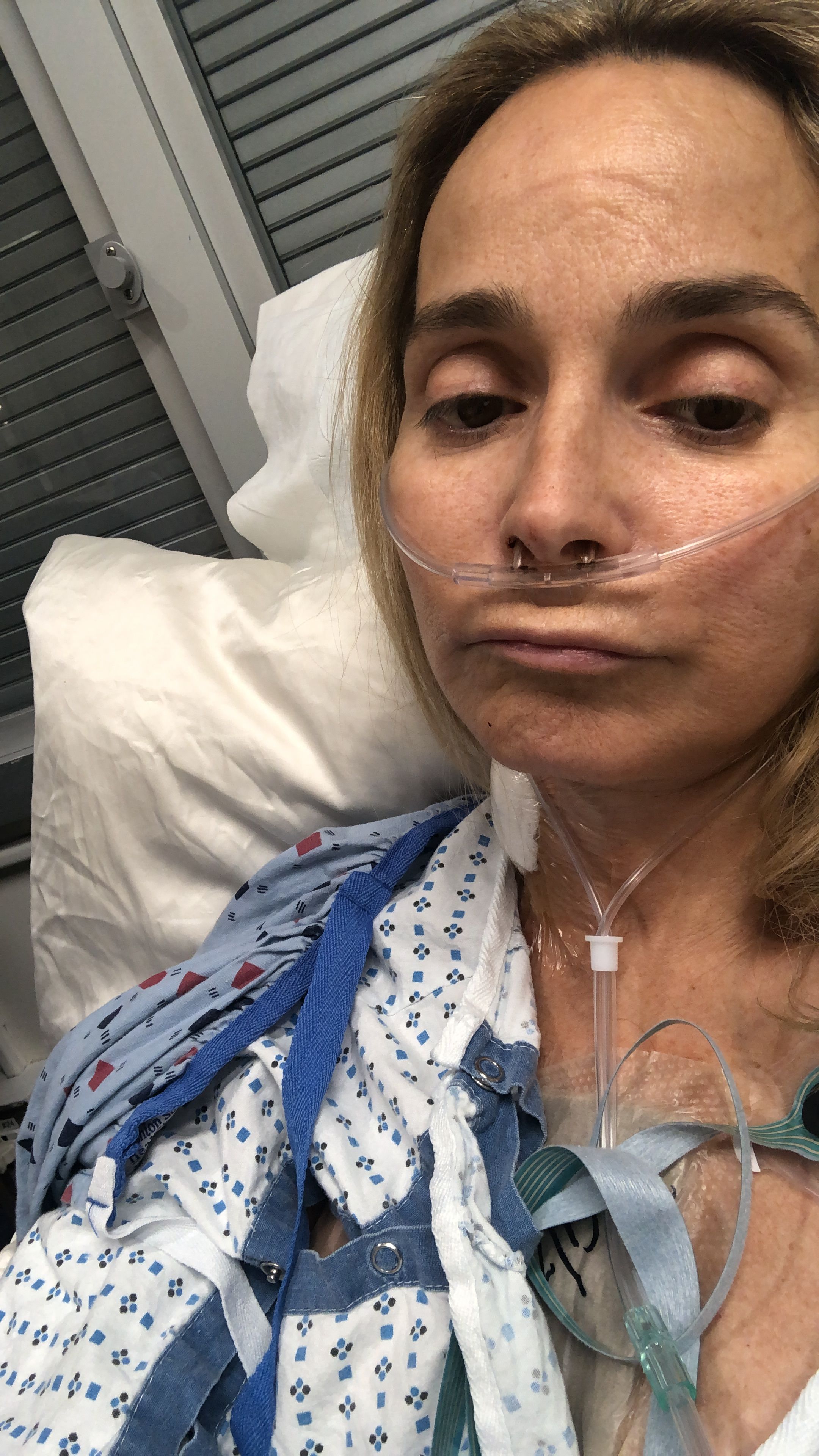 One day post op
