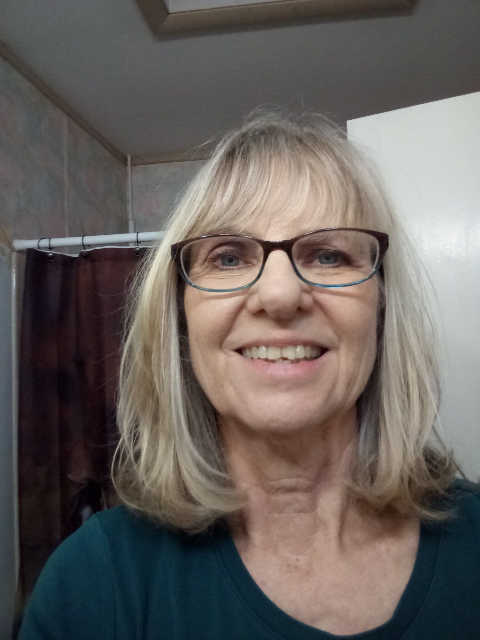 My new haircut before surgery.