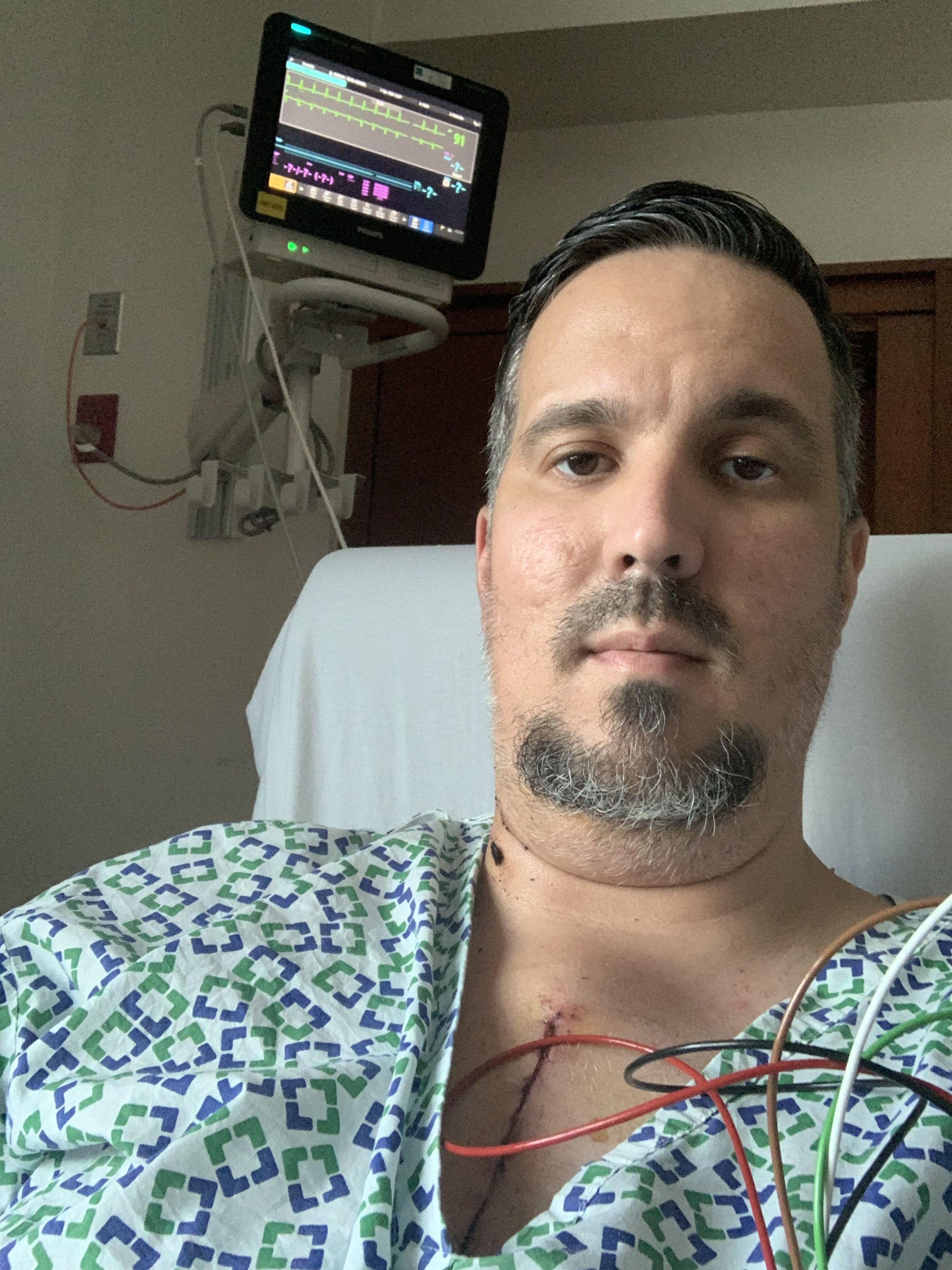 Donâ€™t mind the face I was stoned on morphine lol
