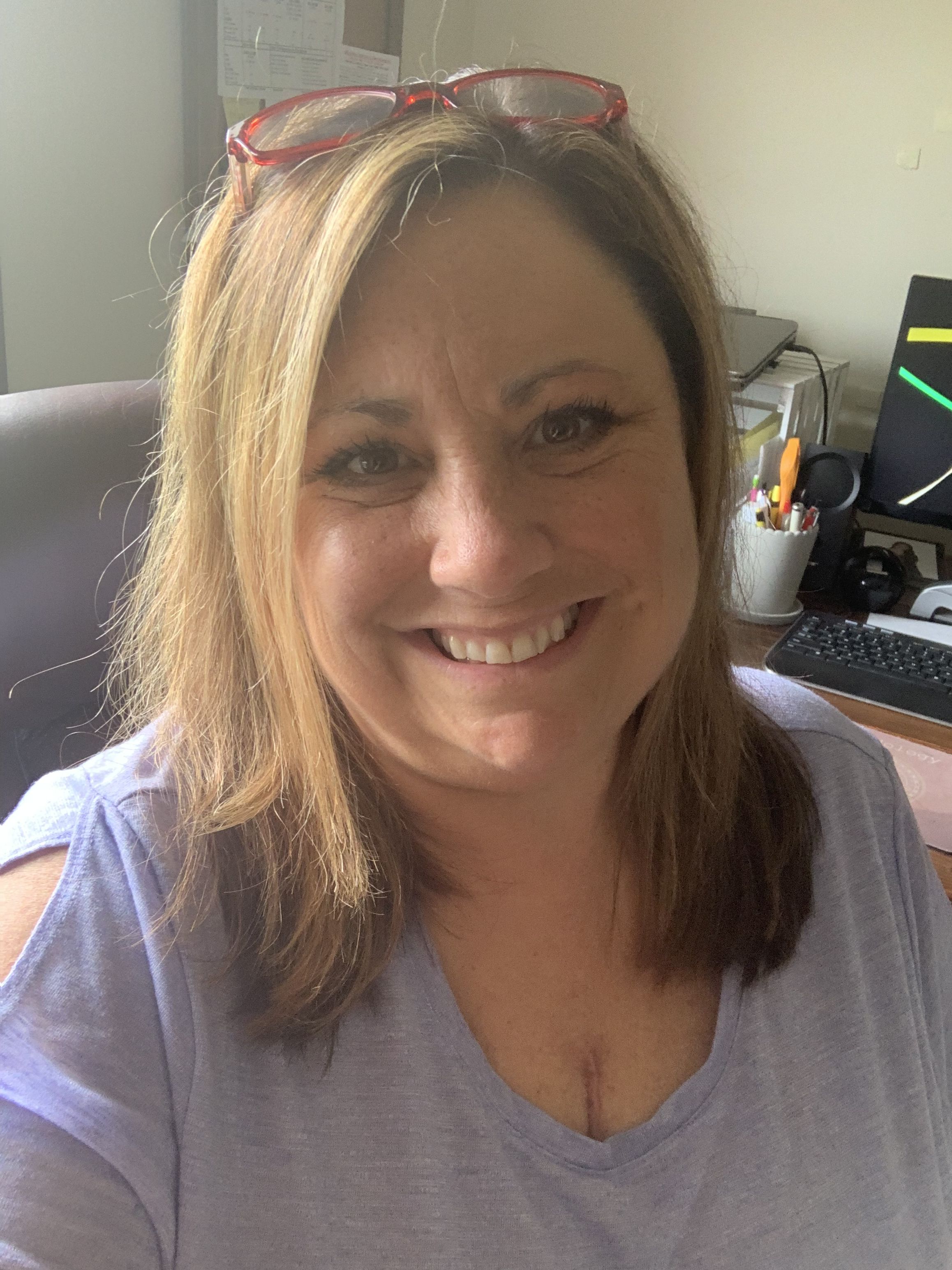 Iâ€™m just 2 days away from 3 weeks post op and just started back to working a little (I work from home). See that little line on my chest? Thatâ€™s not cleavage. Thatâ€™s my scar. My daughter says it gives me â€œStreet Credâ€.