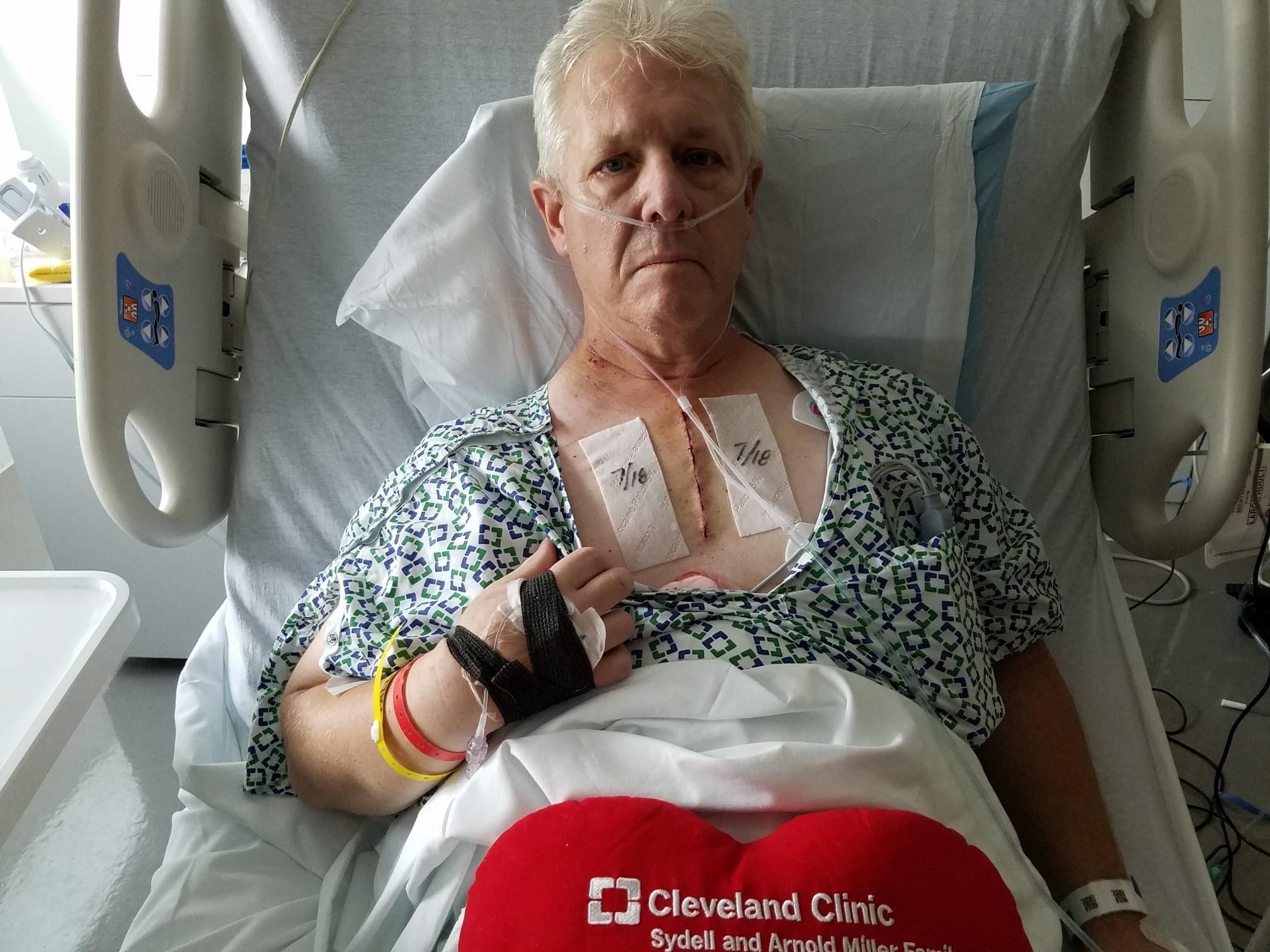 2 days after surgery. Things got a lot better after that. That first day sucked. Just know it will and you will get through it.