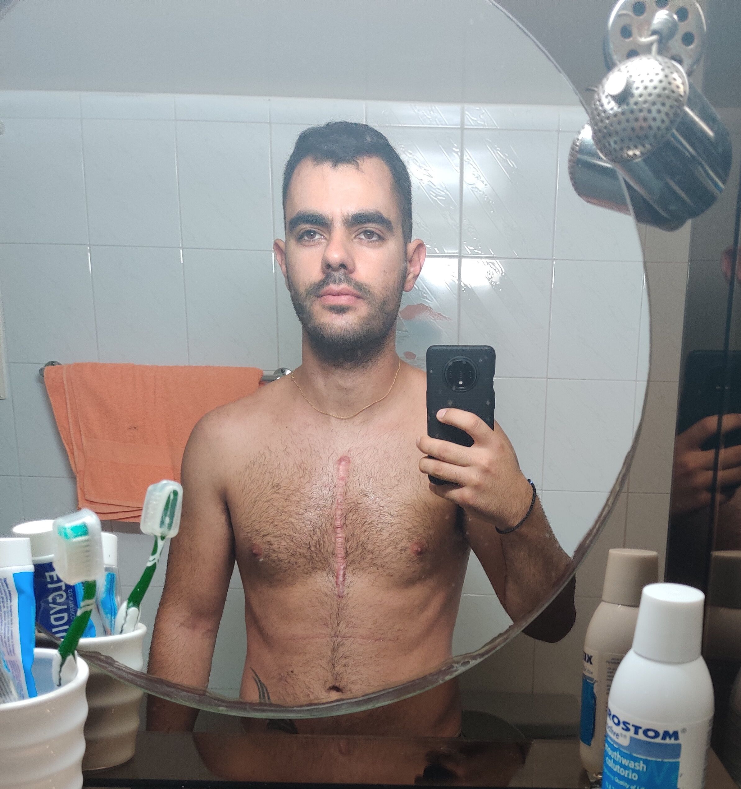 9 months post surgery and I am feeling superb!

I have lost 9kg of fat and gained muscle. My INR levels are stable and I got through a dentist session yesterday!

I workout 5 times per week and walk 10K steps per day. Never give up and always remembe