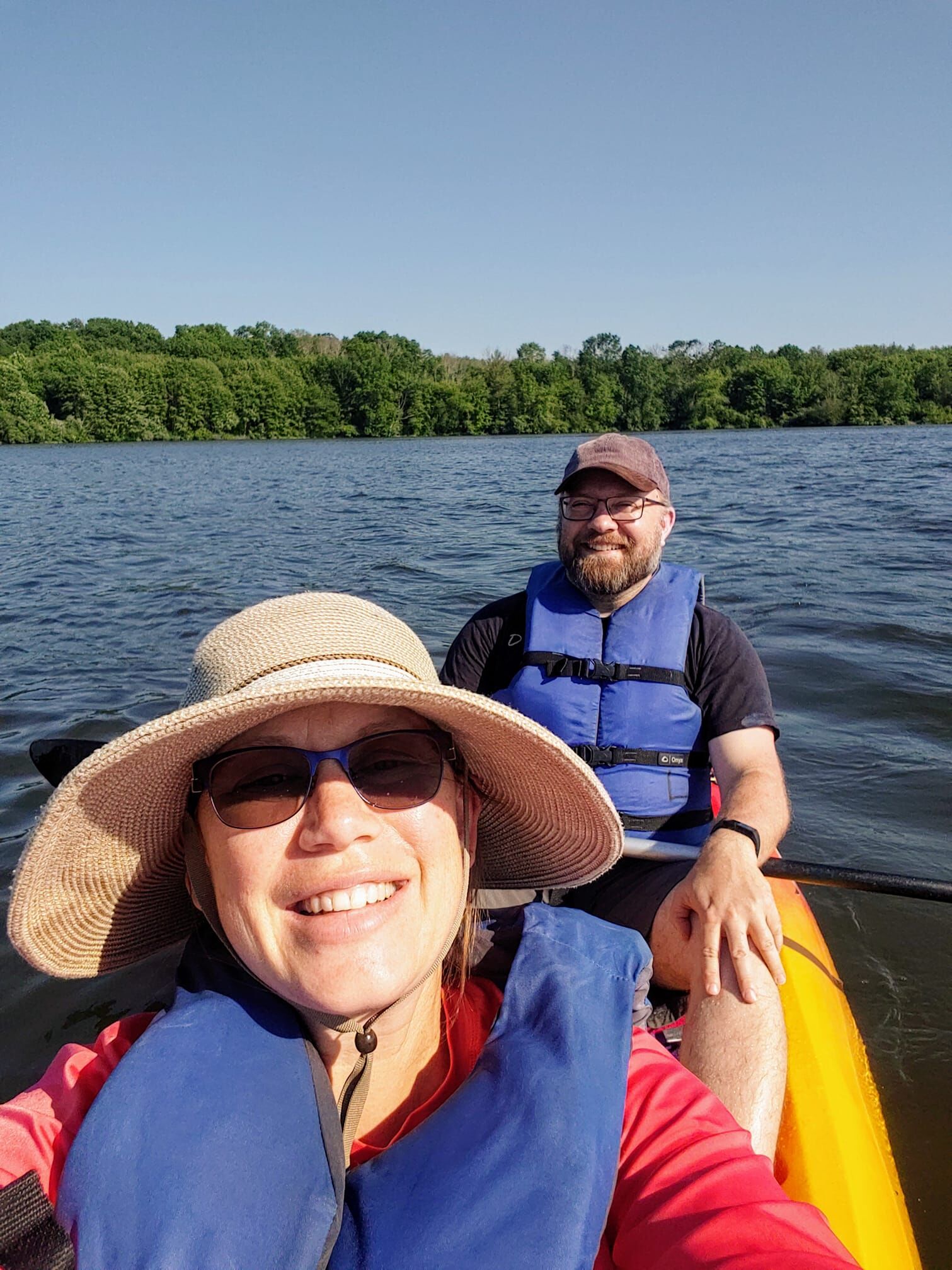 3 months post op; celebrating our anniversary by a nice kayak session on the lake. I feel great, considering!