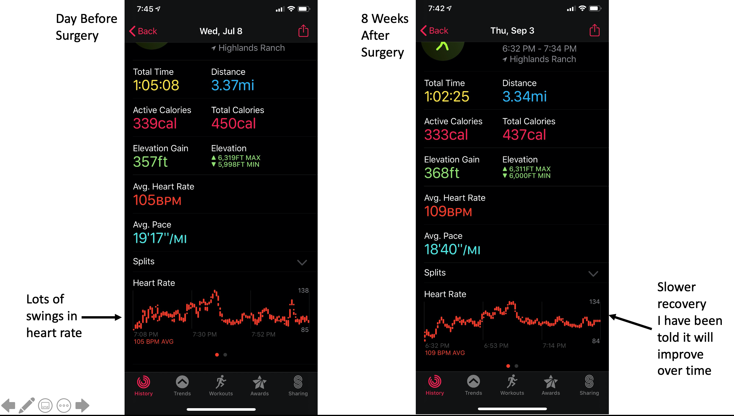 I took the same hike the day before my MV repair and 8 weeks after. Heart rate much improved with less jumps. The only exception is my recovery time is slower. The cardio rehab people tell me that is normal and it will improve with time as I heal