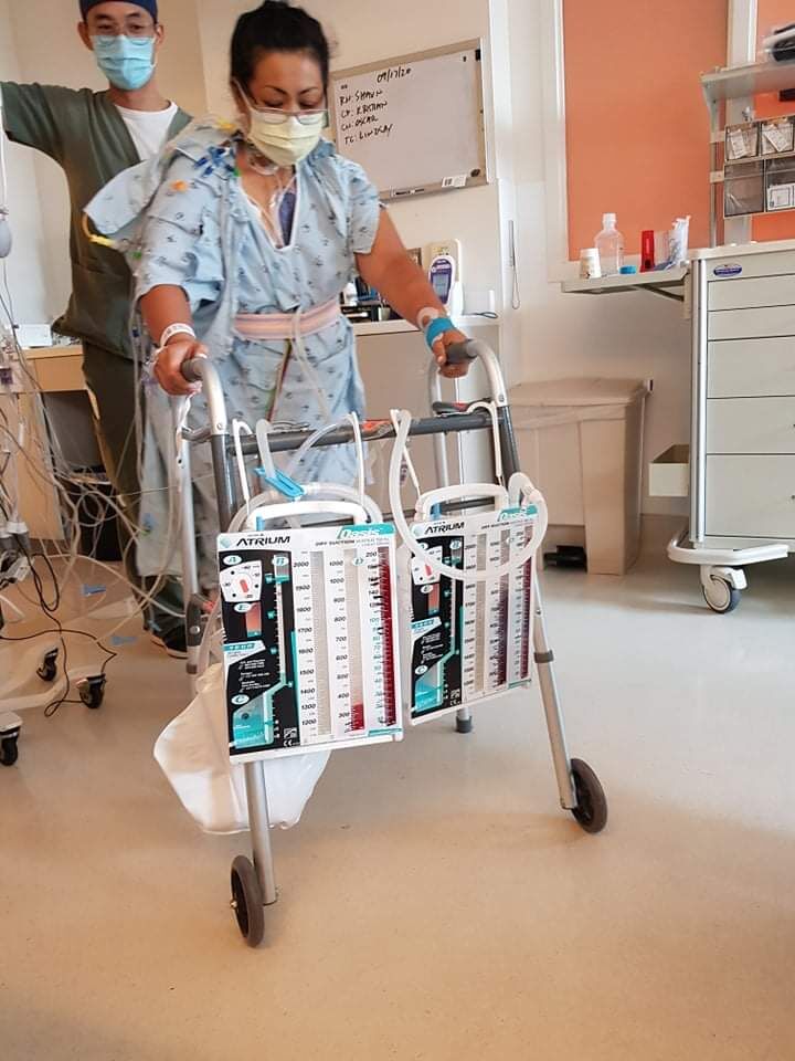Immediate Ambulation after extubation