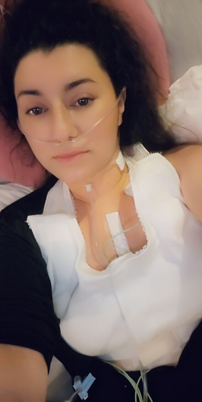 Today I am 4 days Post OP. Valve sparing and repaired my aortic anuerysm. It has been a long hard 4 days. Heart did not want tostart back up, so my stay is a bit longer to see if I am going to need a pacemaker or not!
