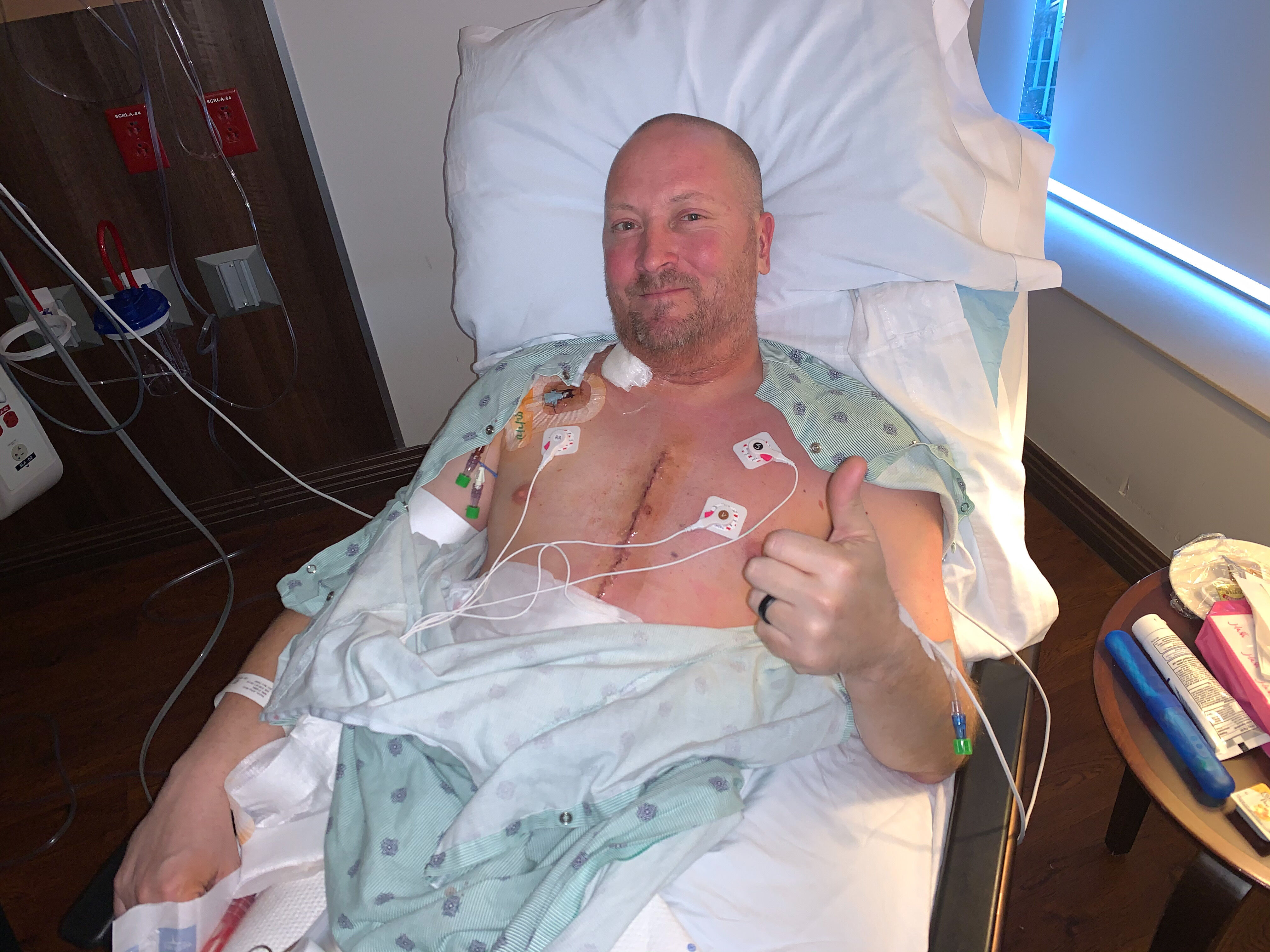 Chest tubes were just removed!