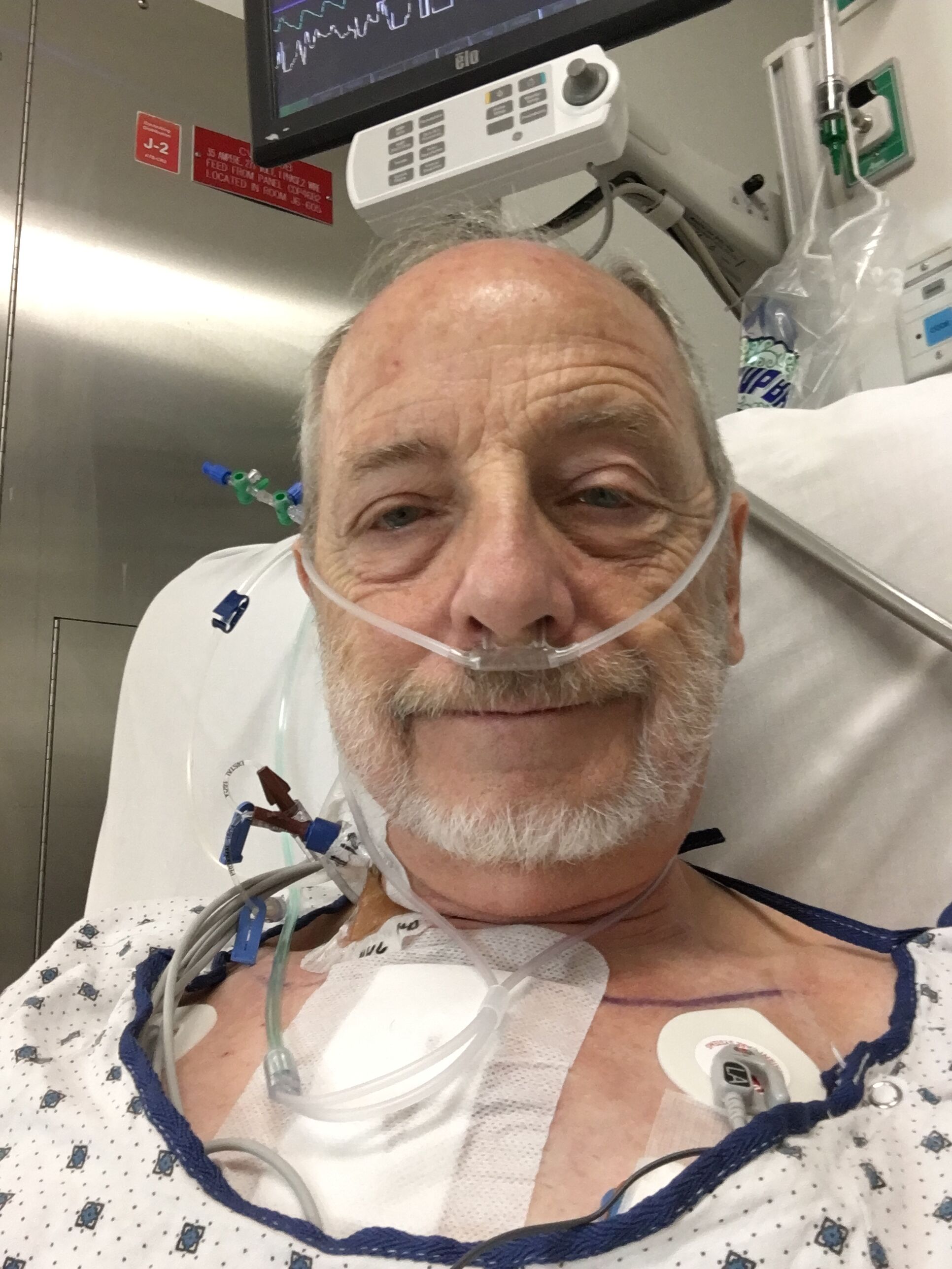 24 hours after surgery. Donâ€™t be alarmed -I look like this normallyâ€¦