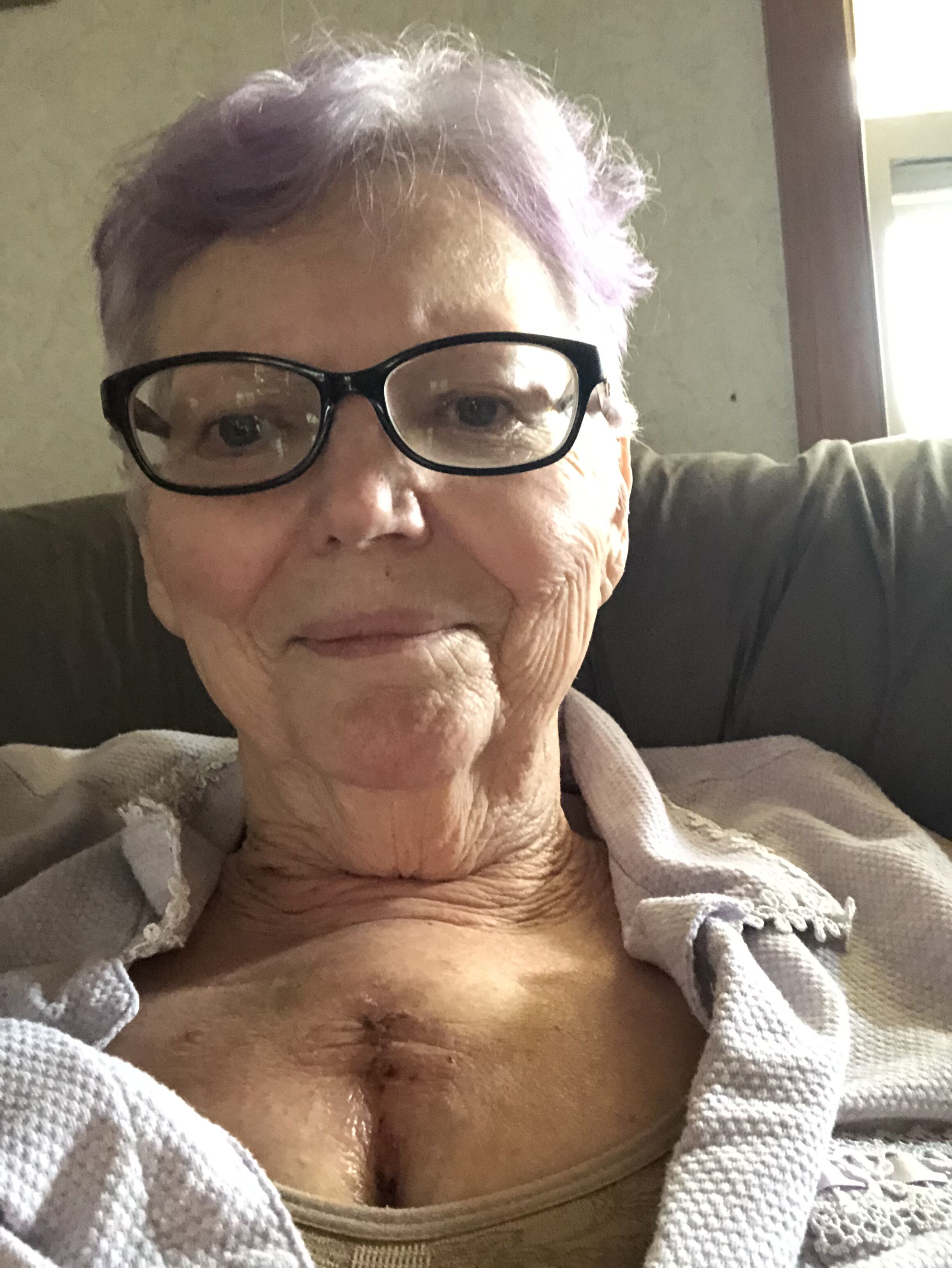Well, here I am 5 days Post Op. Got home yesterday. Sorry it has taken so long to post. This is not an easy road for anyone. I have been so dang tired. But I have a support system that is Great!! Iâ€™m sure it will get better every day.