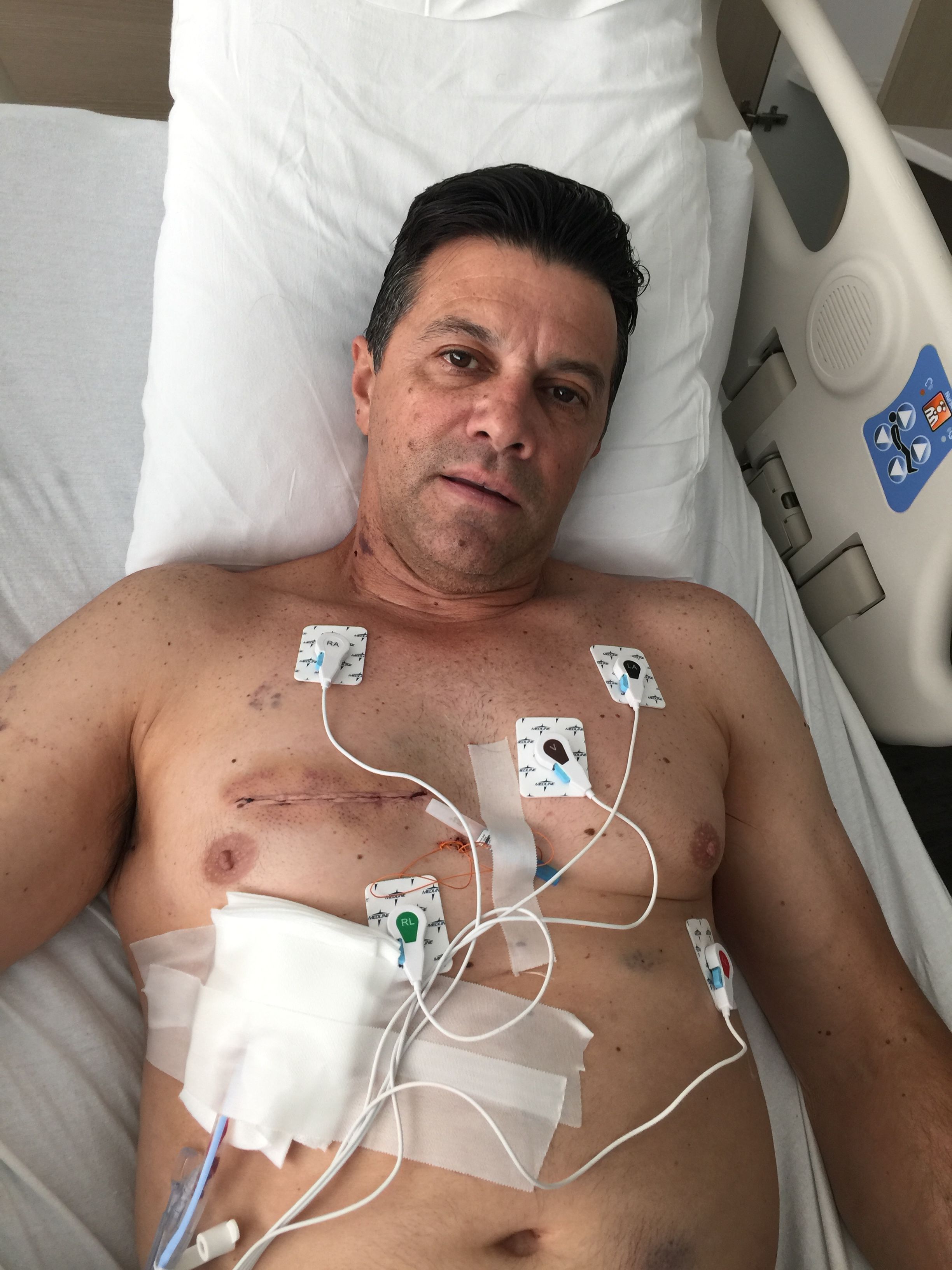 Day 4
Post Op