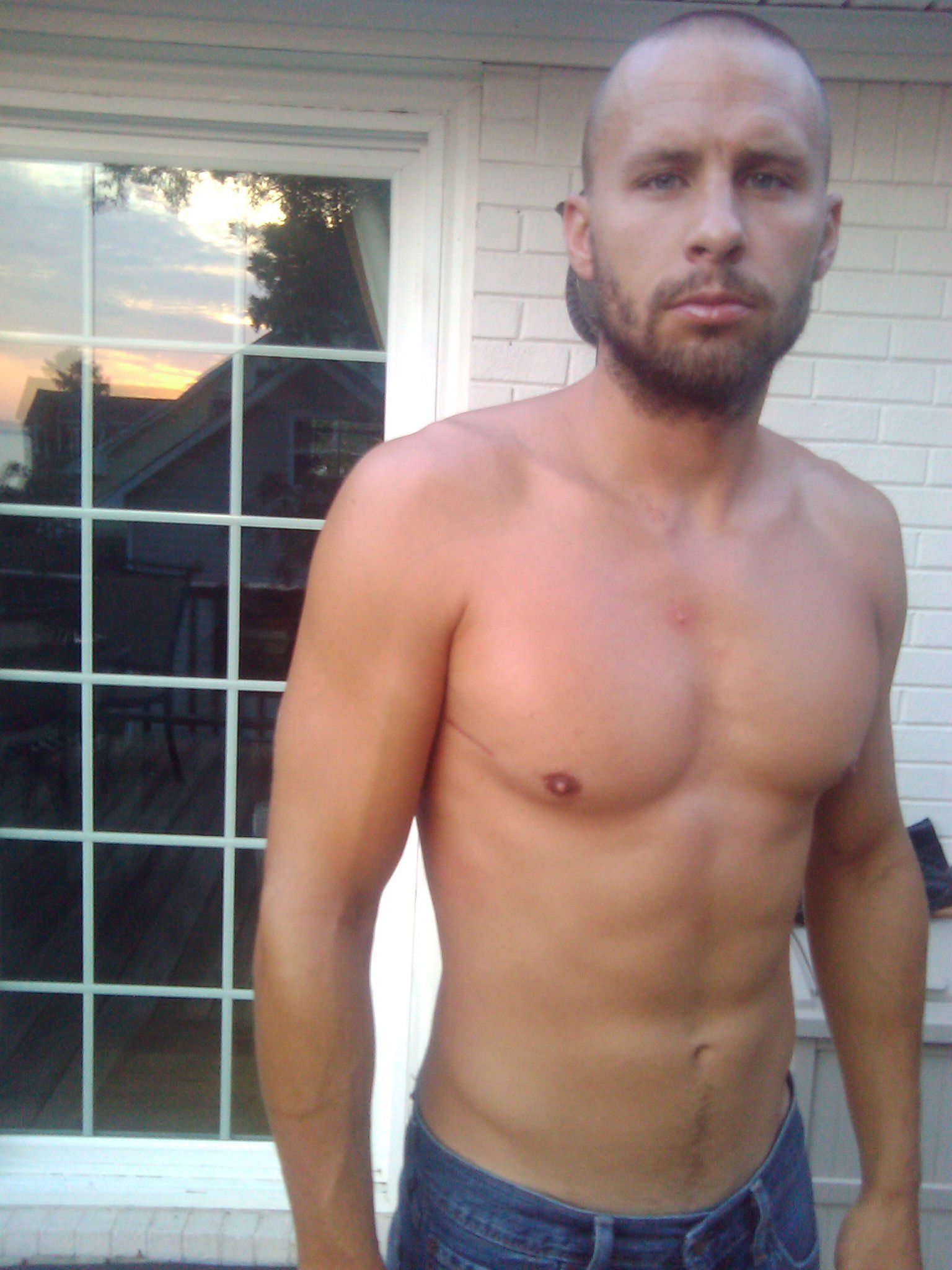 Scars Week 8 chest not deformed