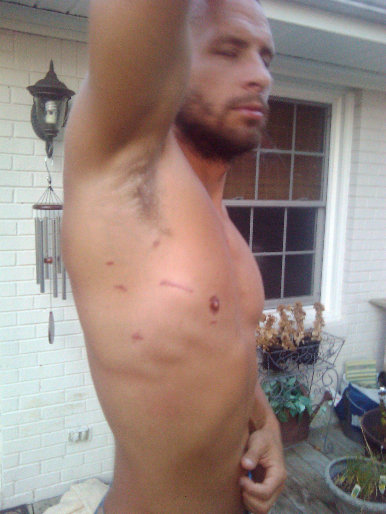 Scars Week 8