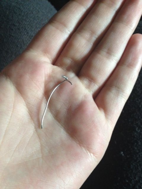 The fractured sternal wire that was removed!