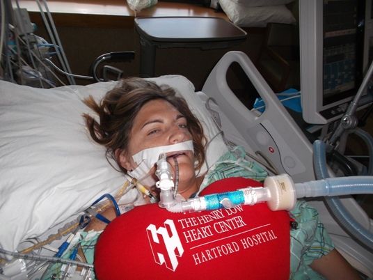 ICU breathing tube