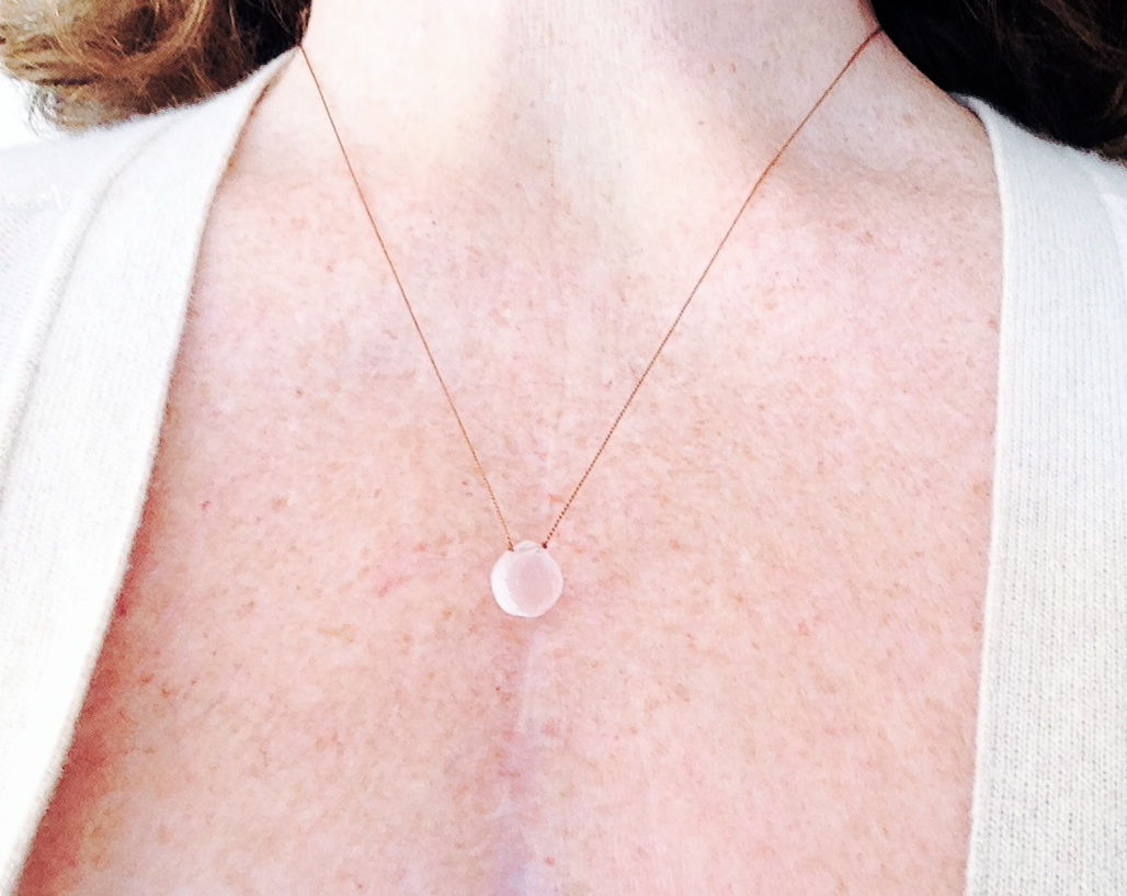 Today is a special day for me. One year ago this morning, in San Francisco, I had my Aortic Valve replaced. I will never forget the loving kindness shown to me by so many in my life and here on this website..Jim, Dan, Carol,Ernie and others, we all were t