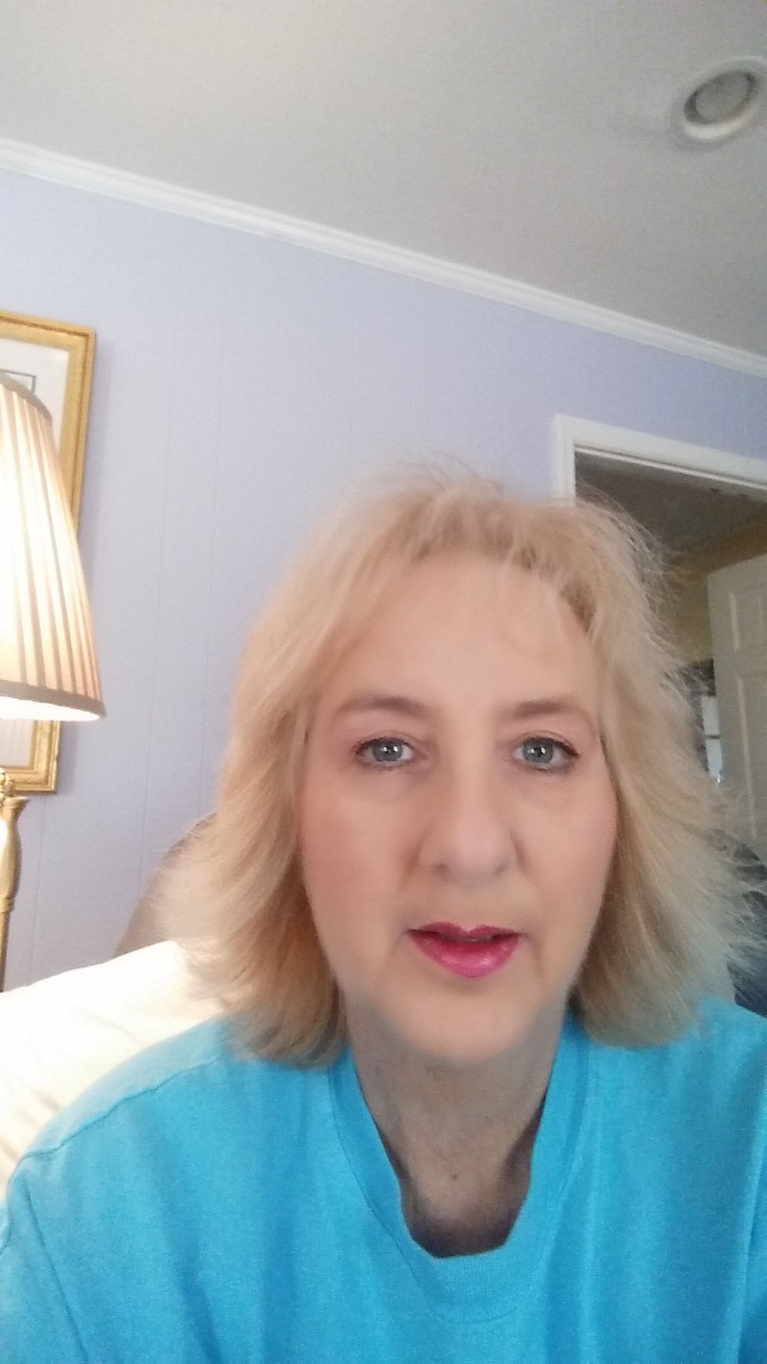 I lost 20 lbs. pre-surgery and 10 more lbs. post-surgery. You can sure see it in my face.