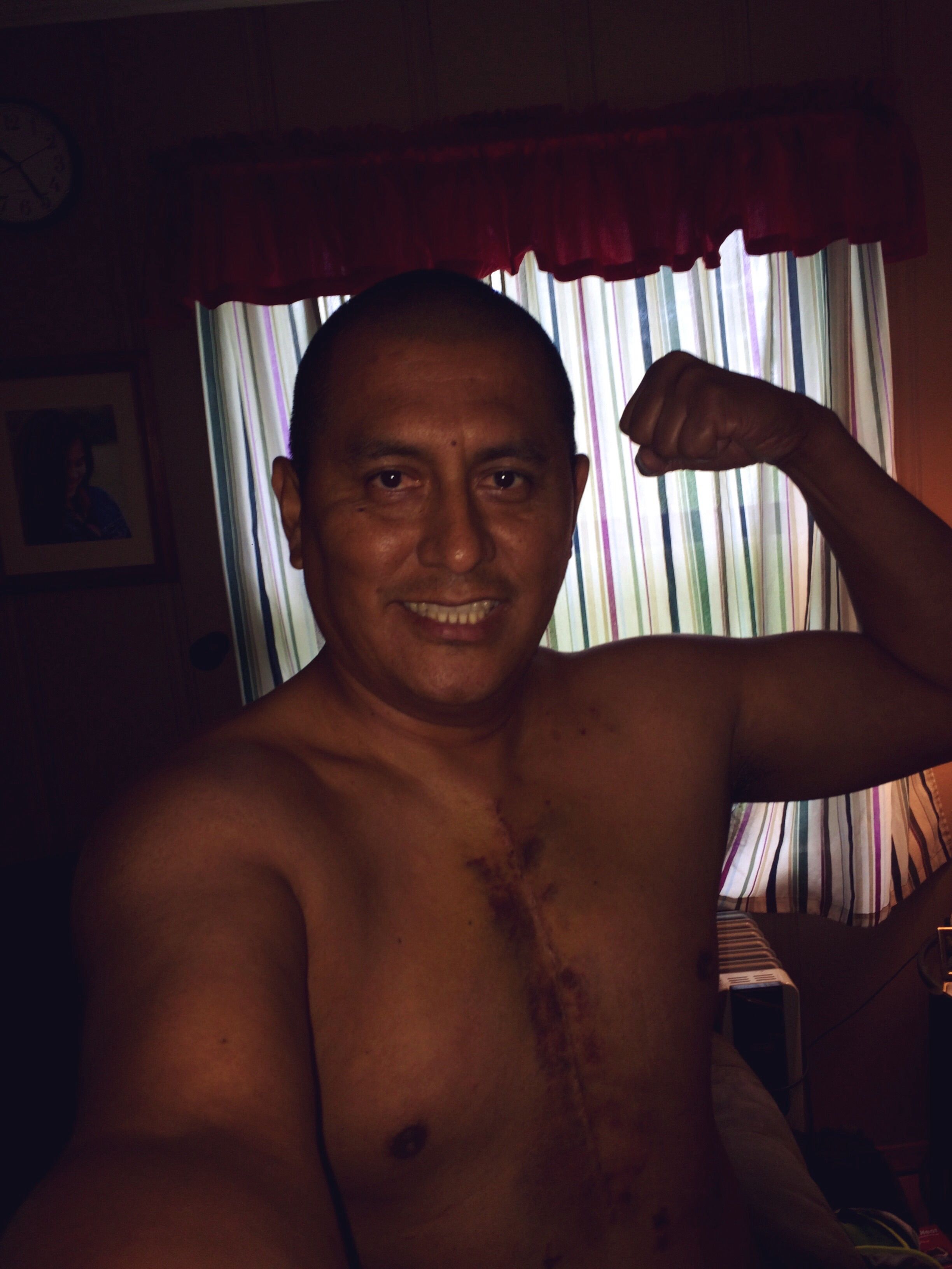 7th day post aortic valve replacement! Thank you Jesus