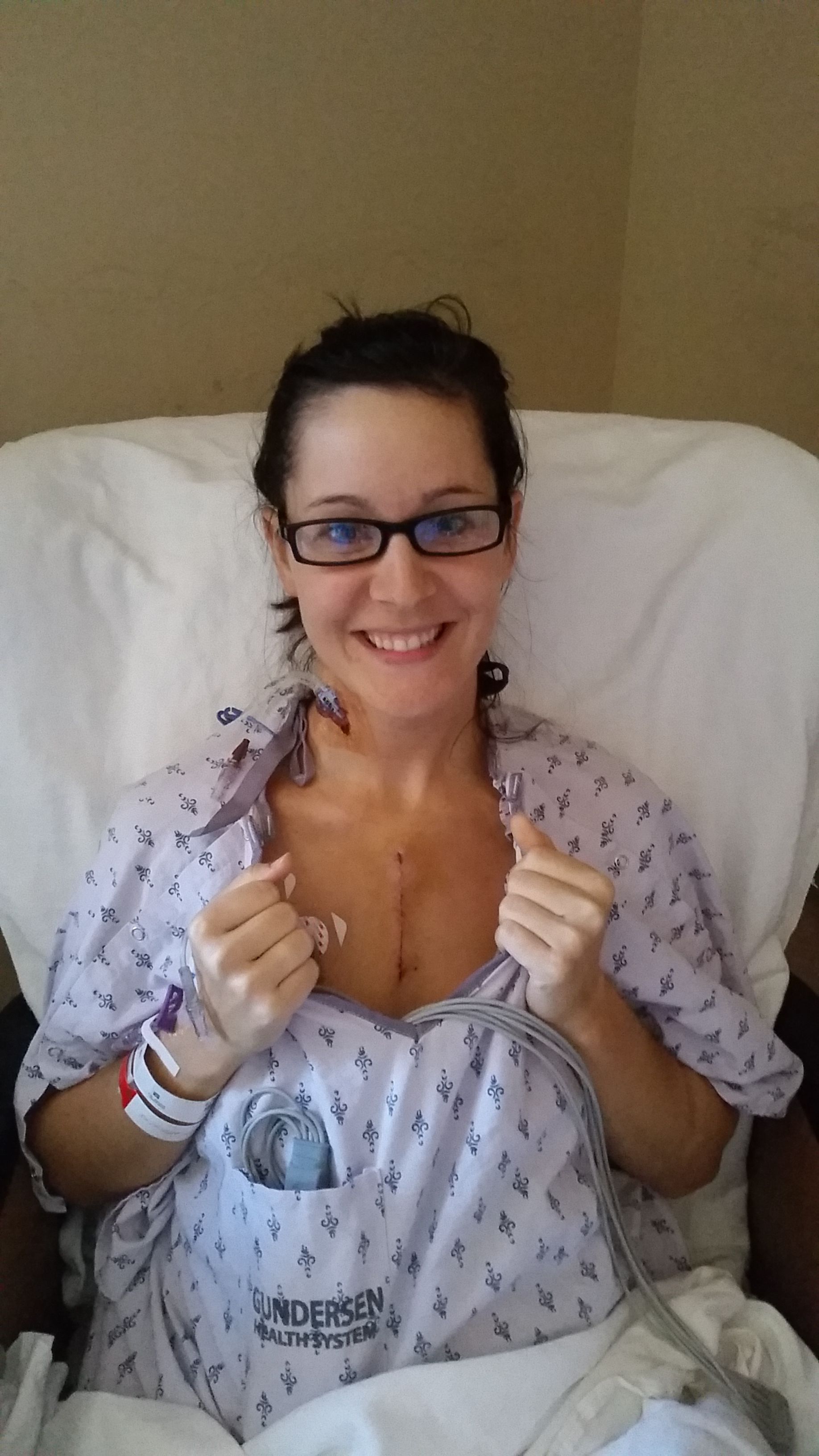 2 days Post Op. I feel great and hoping to go home tomorrow!!