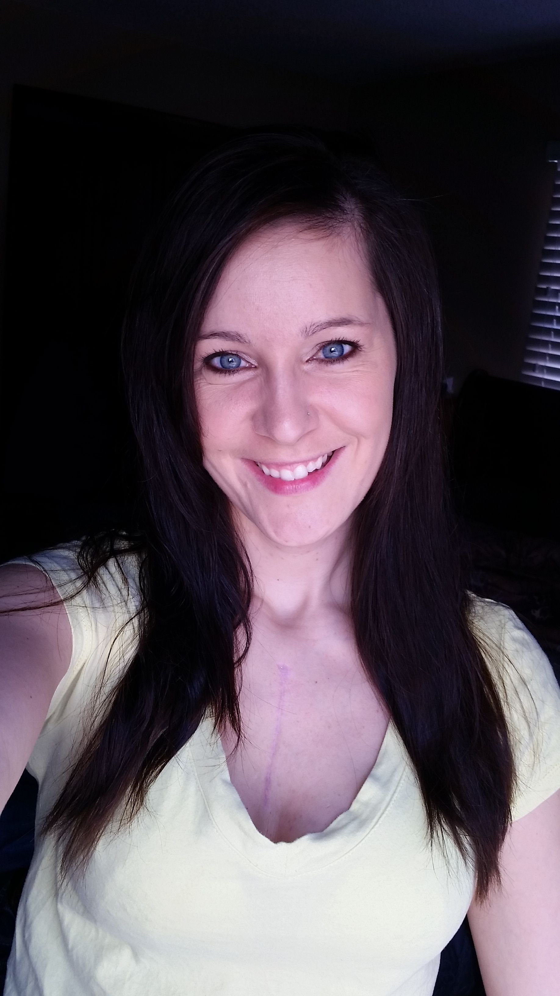 This is me today, 4 months post-op!!! Feeling blessed. :)