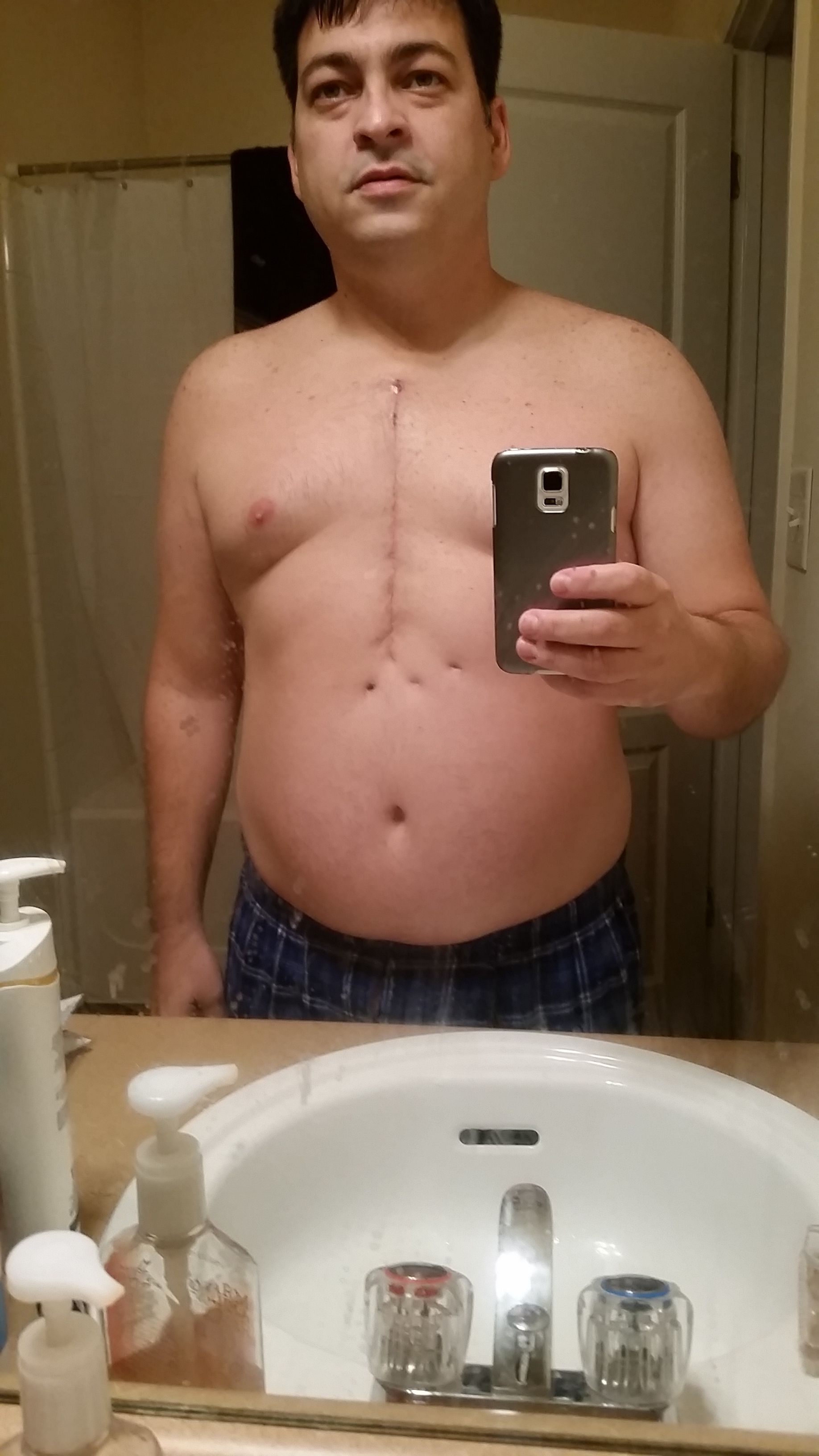 3 weeks after surgery...1 day at the time...getting back.