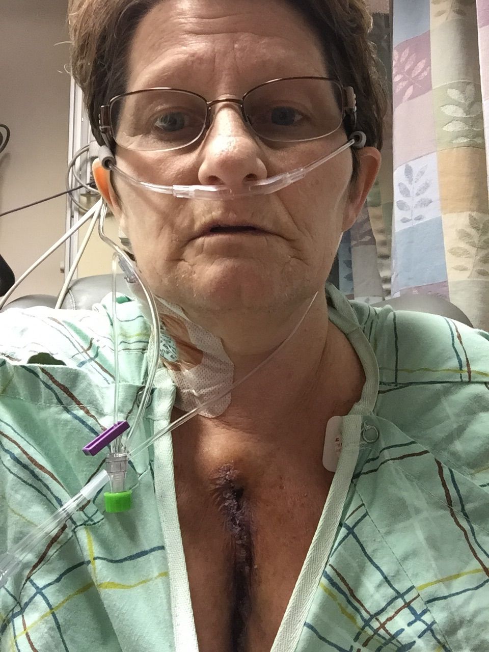 Hospital stay. Ready to get all these lines out.