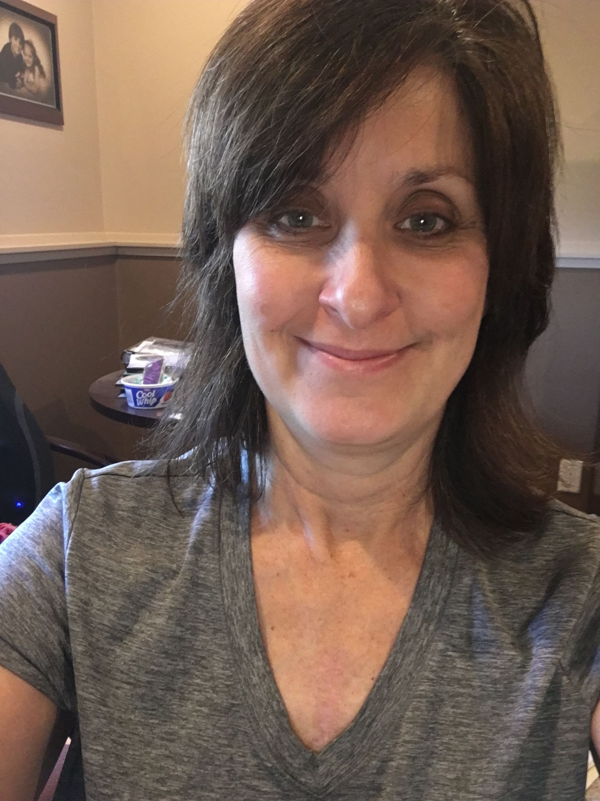 One year post Ross Procedure with Dr. Paul Stelzer in New York - I'd have to say my scar is looking quite nice! Hard to believe it's been a year. I am feeling very blessed and thankful for this being behind me. Prayers to all of you in the waiting room -