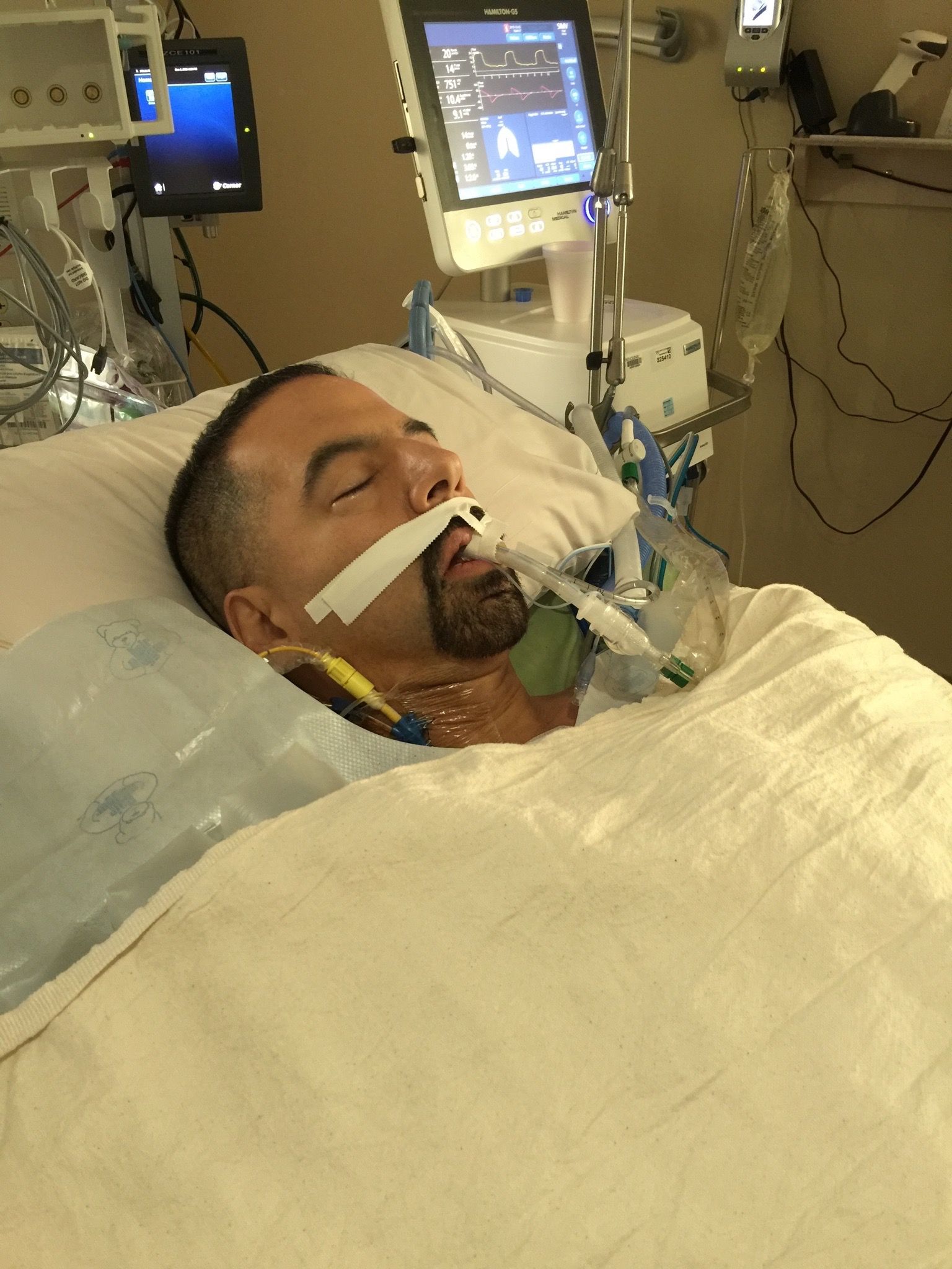 Fresh post-op, in dreamland...waking up with the ETT was something I had dreaded pre-op...I was right...when then put you on spontaneous and you have to breath through a straw!