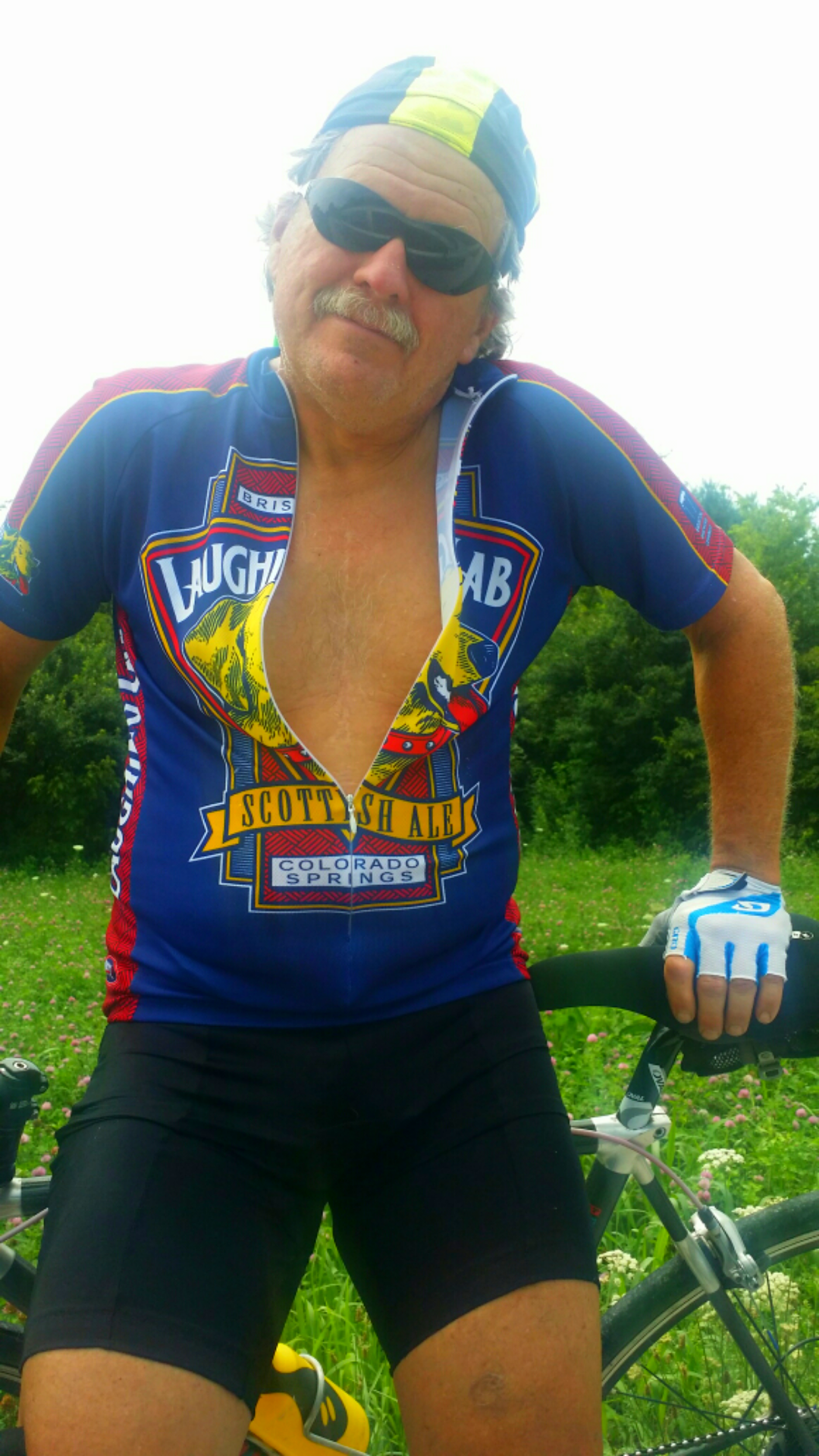 That's me, that's my bike, that's my second scar