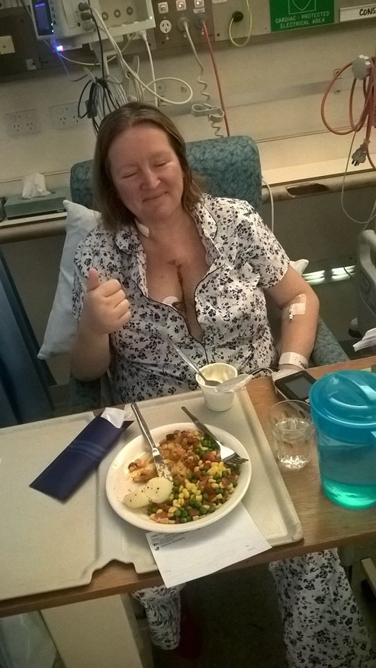 5 days after Maze procedure, Hole in heart repair and ablation .....this was 10 days ago now home :)