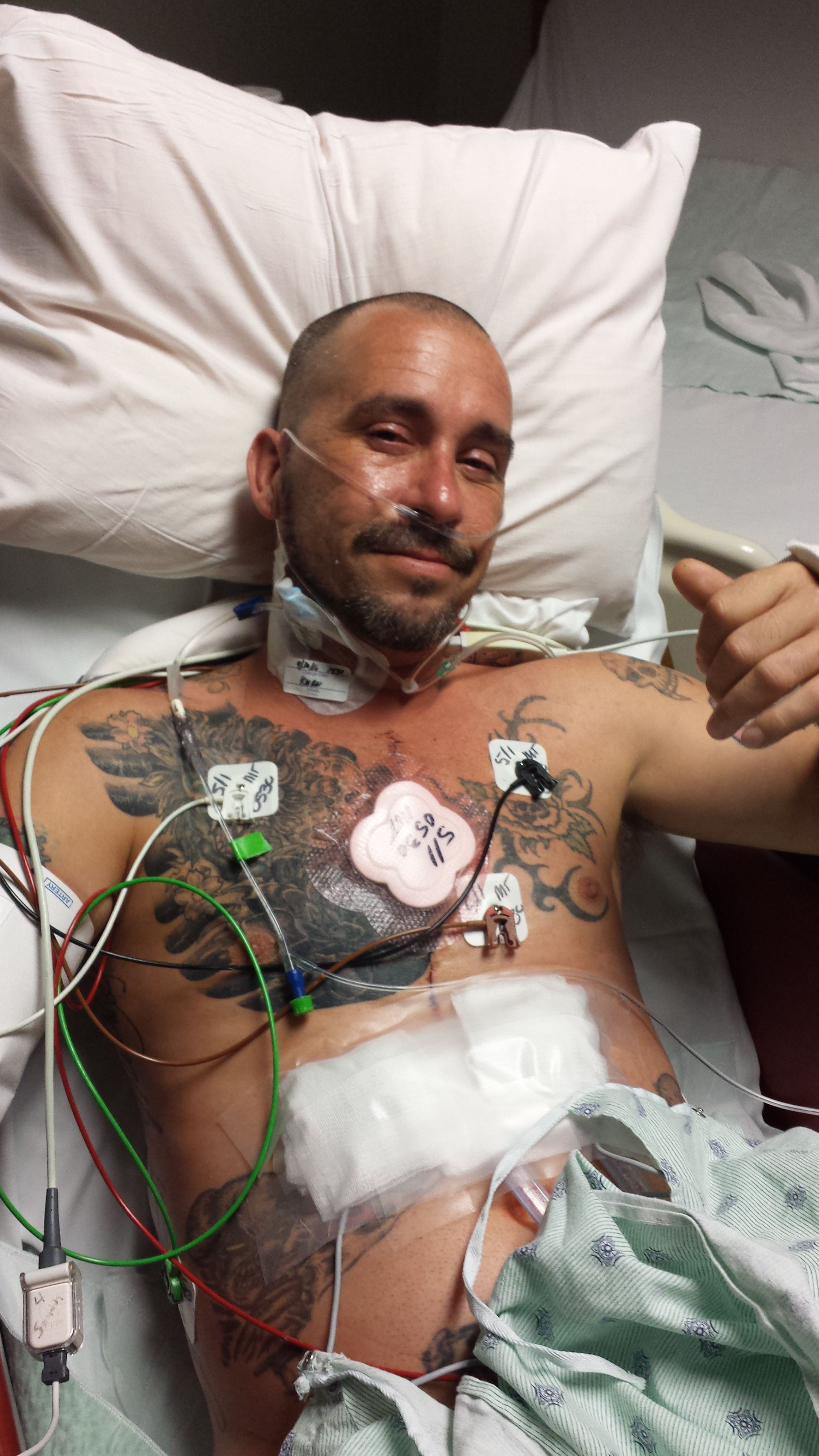 3 days after surgery! However today is day 6.
I'm very proud of my husband and so very thankful for his amazing surgeon.