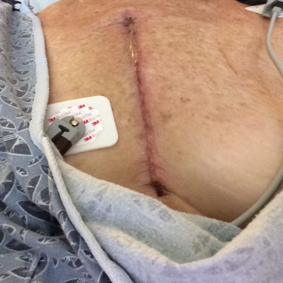 Scar selfie