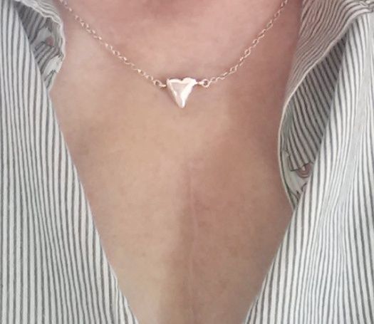 Was in the middle of mitral valve repair surgery one year ago today! Here's what a one year old scar looks like :) Thanks & best wishes everyone!