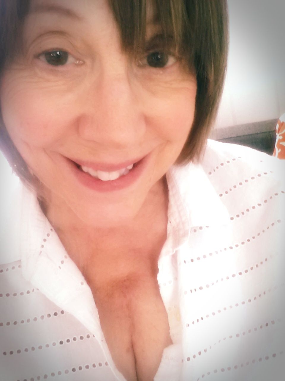 My scar at 3 1/2 weeks. ( that's not cleavage, that's my scar:)) I had a full sternotomy- it healed so fast!