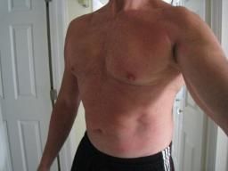 Big scar from throat to stomach. left upper chest is caved in. I take this major surgery now for granted. Still have this shape (well kind of) alot older alot grayer. Heart operation didn't stop me.