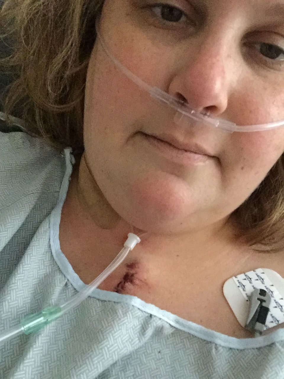 Day 3 started feeling better but then I needed 2 units of blood