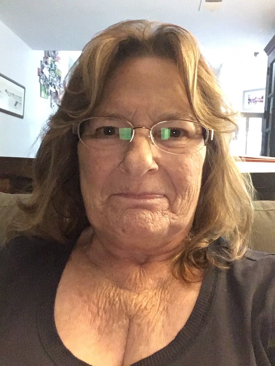 2 yrs post op AVR
June 14,2016
