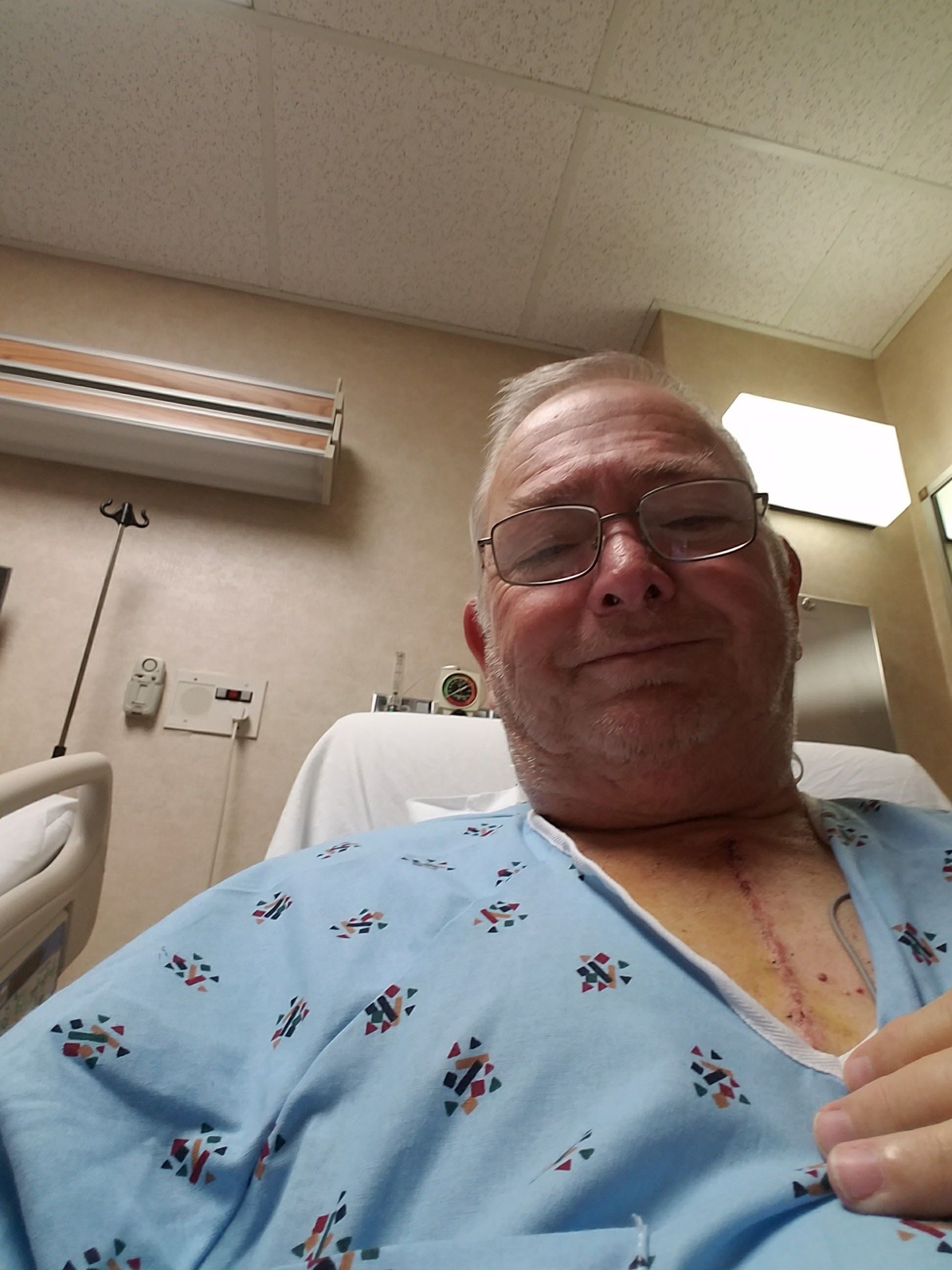 February 5 2017.....6 days in ICU and finally in stepdown.